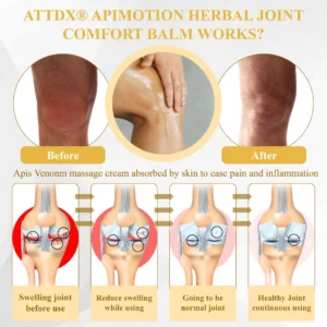 ATTDX® PuffEase Edema Therapy Massage Cream