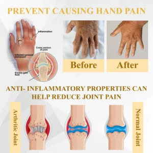 ATTDX® PuffEase Edema Therapy Massage Cream