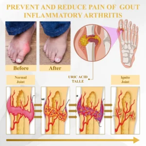ATTDX® PuffEase Edema Therapy Massage Cream