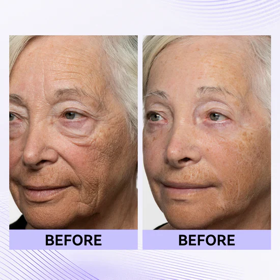 Instant Eye Tightener Easy-Wear Formula With Brush Free!