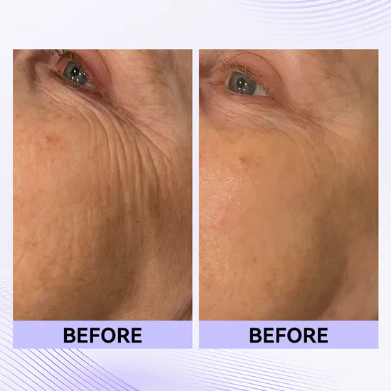 Instant Eye Tightener Easy-Wear Formula With Brush Free!