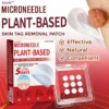 Juxek™ MicroNeedle Plant-based Skin Tag Removal Patch Made in the USA