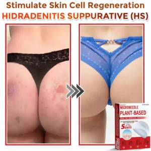 Juxek™ MicroNeedle Plant-based Skin Tag Removal Patch Made in the USA