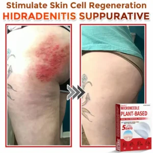Juxek™ MicroNeedle Plant-based Skin Tag Removal Patch Made in the USA