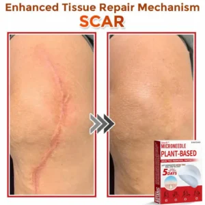 Juxek™ MicroNeedle Plant-based Skin Tag Removal Patch Made in the USA