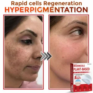 Juxek™ MicroNeedle Plant-based Skin Tag Removal Patch Made in the USA