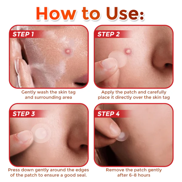 Juxek™ MicroNeedle Plant-based Skin Tag Removal Patch Made in the USA