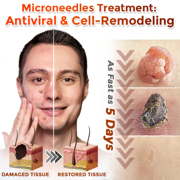 Juxek™ MicroNeedle Plant-based Skin Tag Removal Patch Made in the USA