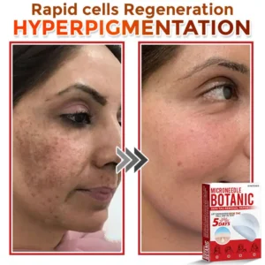 LOVILDS® MicroNeedle Botanic Skin Tag Removal Patch