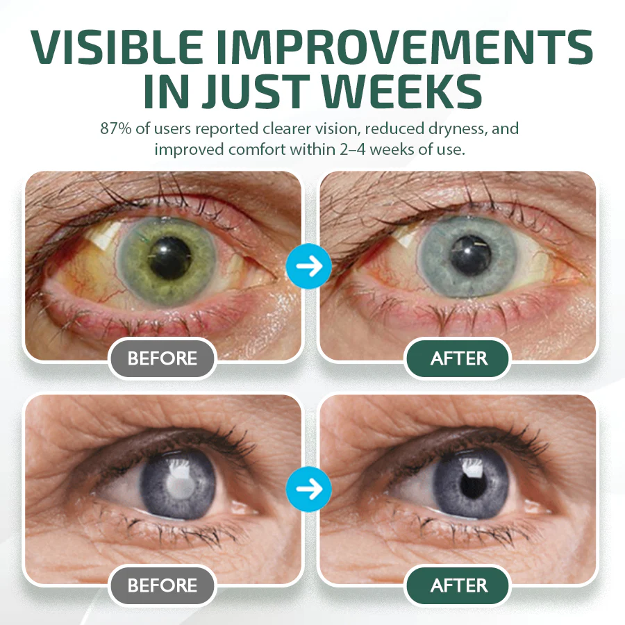 NEGUSY™ Nano Eye Drops Serum