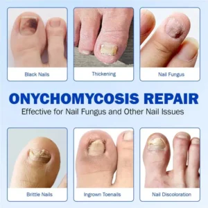 Nail Health Care Patches – Repair and Strengthen Weak Nails