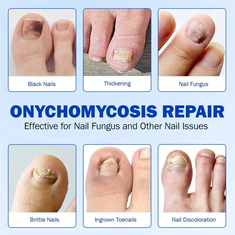 Nail Health Care Patches – Repair and Strengthen Weak Nails