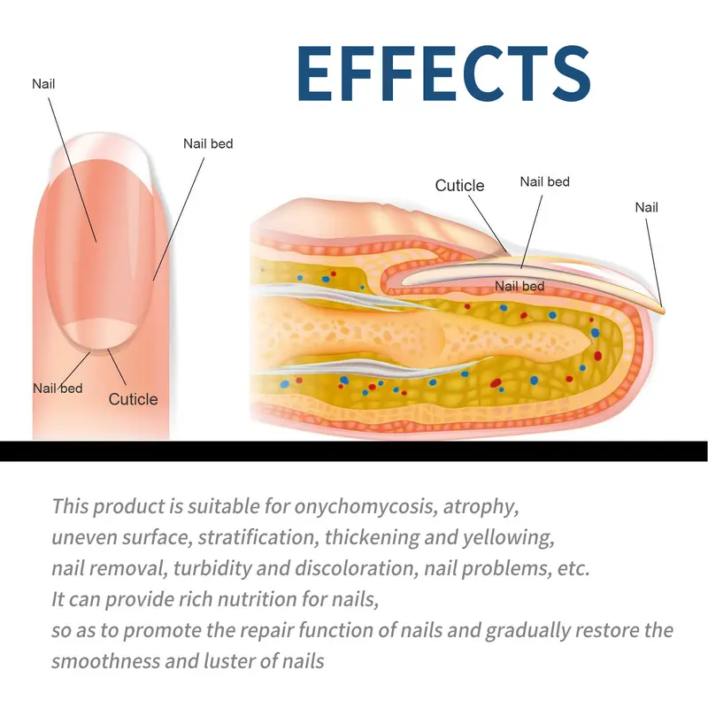 Nail Health Care Patches – Repair and Strengthen Weak Nails