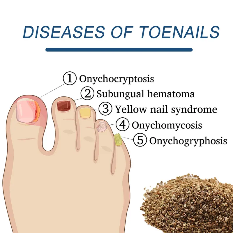 Nail Health Care Patches – Repair and Strengthen Weak Nails