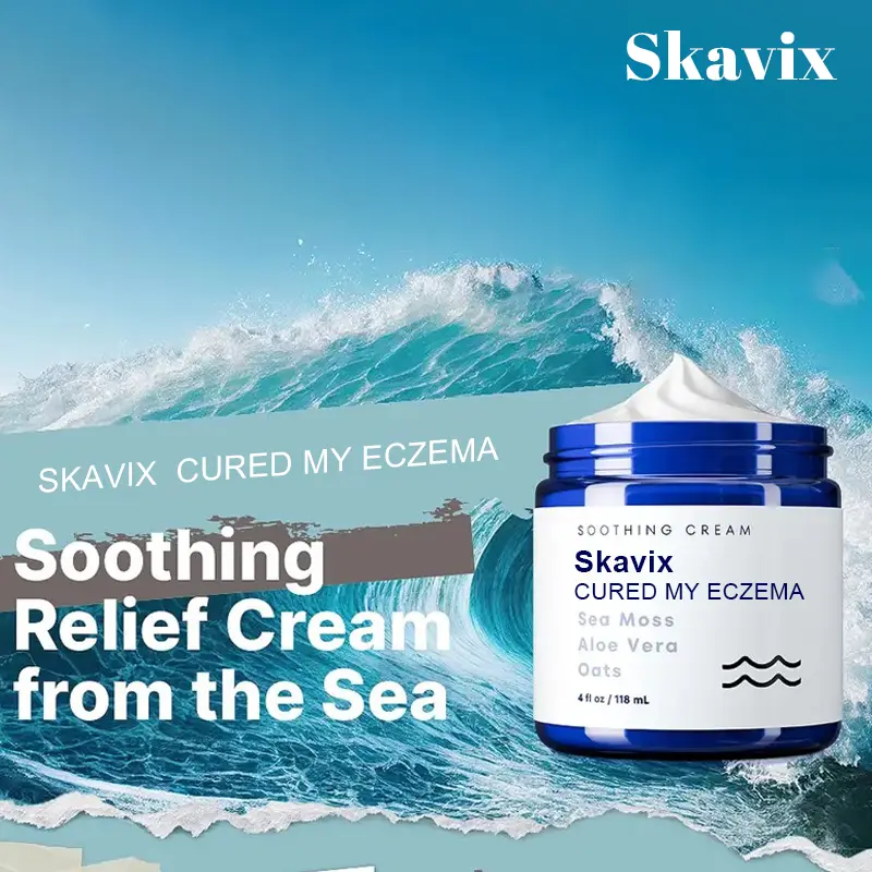 Skavix Natural soothing cream - relieves eczema and psoriasis - marine minerals - for sensitive skin - moisturizing eczema cream for dry skin