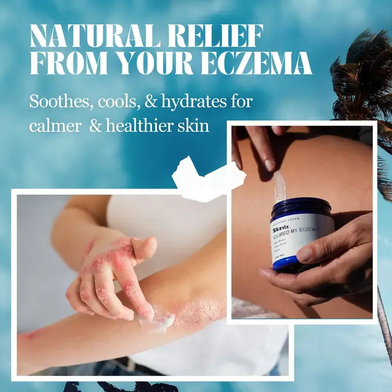 Skavix Natural soothing cream - relieves eczema and psoriasis - marine minerals - for sensitive skin - moisturizing eczema cream for dry skin