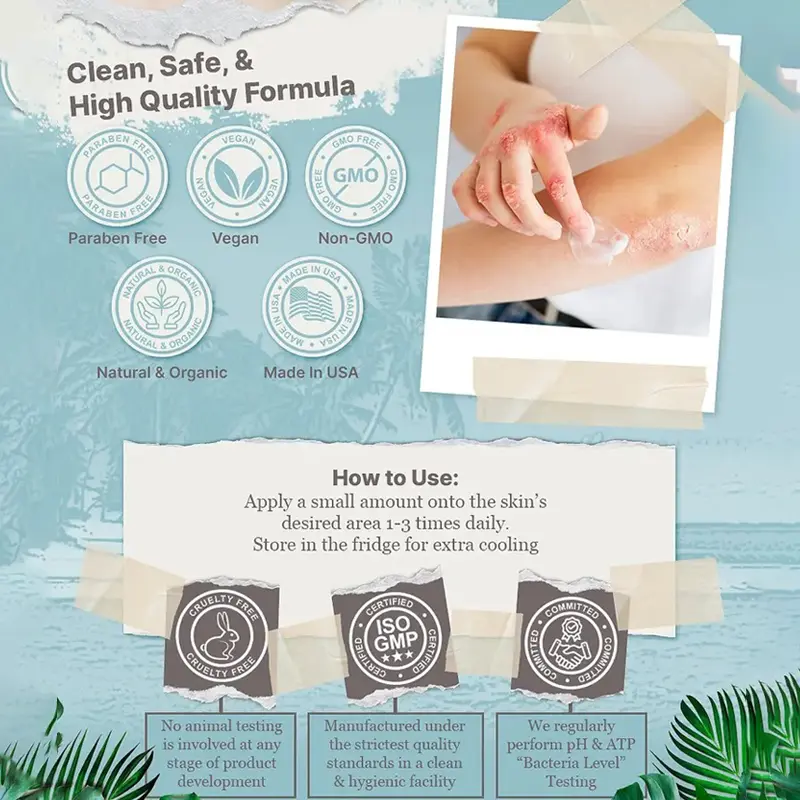 Skavix Natural soothing cream - relieves eczema and psoriasis - marine minerals - for sensitive skin - moisturizing eczema cream for dry skin