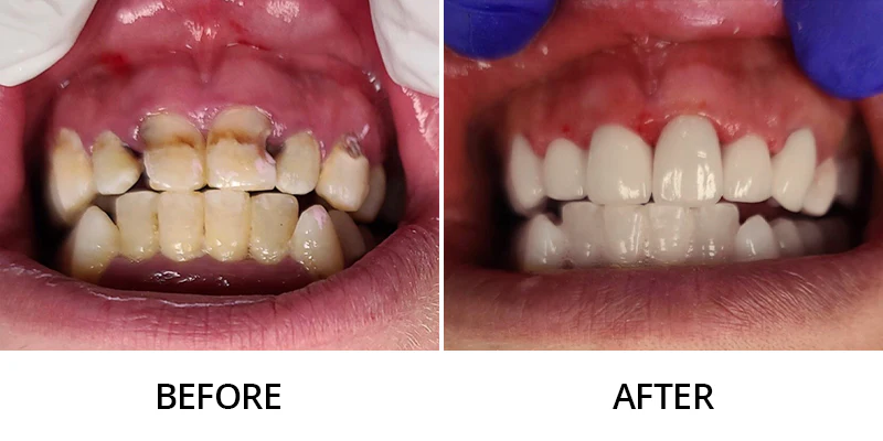 Skavix™ Nature Oral Care Toothpaste