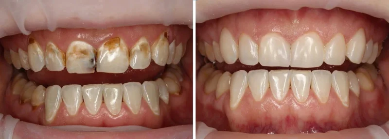 Skavix™ Nature Oral Care Toothpaste