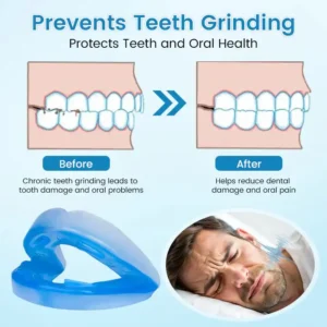 Winter Sale Blizkox™ SnoreRelief – FDA-Approved Anti-Snoring Mouthpiece