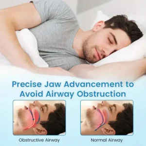 Winter Sale Blizkox™ SnoreRelief – FDA-Approved Anti-Snoring Mouthpiece
