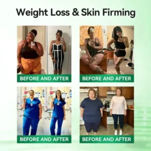 𝐂𝐥𝐞𝐫𝐚𝐋𝐮𝐱𝐞® BrownFat Extract Nano Microneedle Patch