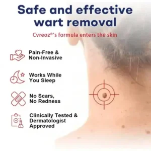 Cvreoz® Mole and Wart Removal Cream