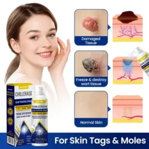 NESLEMY® ChillErase Bump Renewal Spray
