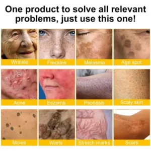 Ourlyard® Bee venom Pro Comprehensive Cream
