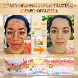Rolimey® Bee Venom Skin Restoration Cream