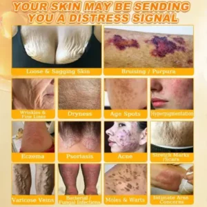 Rolimey® Bee Venom Skin Restoration Cream