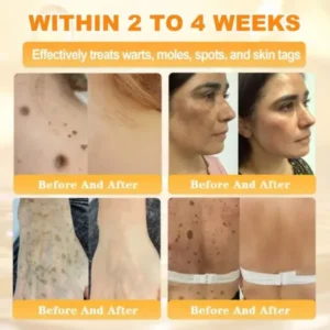 Rolimey® Bee Venom Skin Restoration Cream