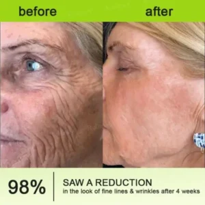 Rolimey® Botox & Vita-A Retinol Shot Wrinkle-Lift Tightening cream