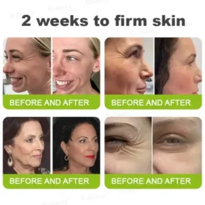 Rolimey® Botox & Vita-A Retinol Shot Wrinkle-Lift Tightening cream