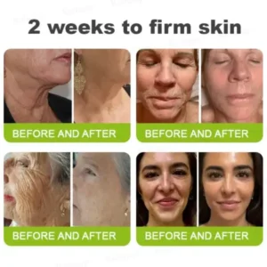 Rolimey® Botox & Vita-A Retinol Shot Wrinkle-Lift Tightening cream